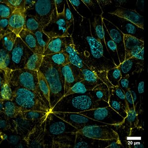 New organ-on-chip system to help study how neurotoxins move from the gut to the brain